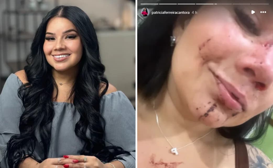 Cantora cuiabana sofre acidente de trânsito em Cuiabá