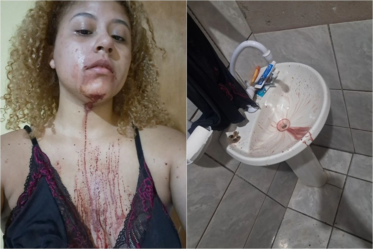 Estudante denuncia policiais militares por agressão em Cuiabá MT