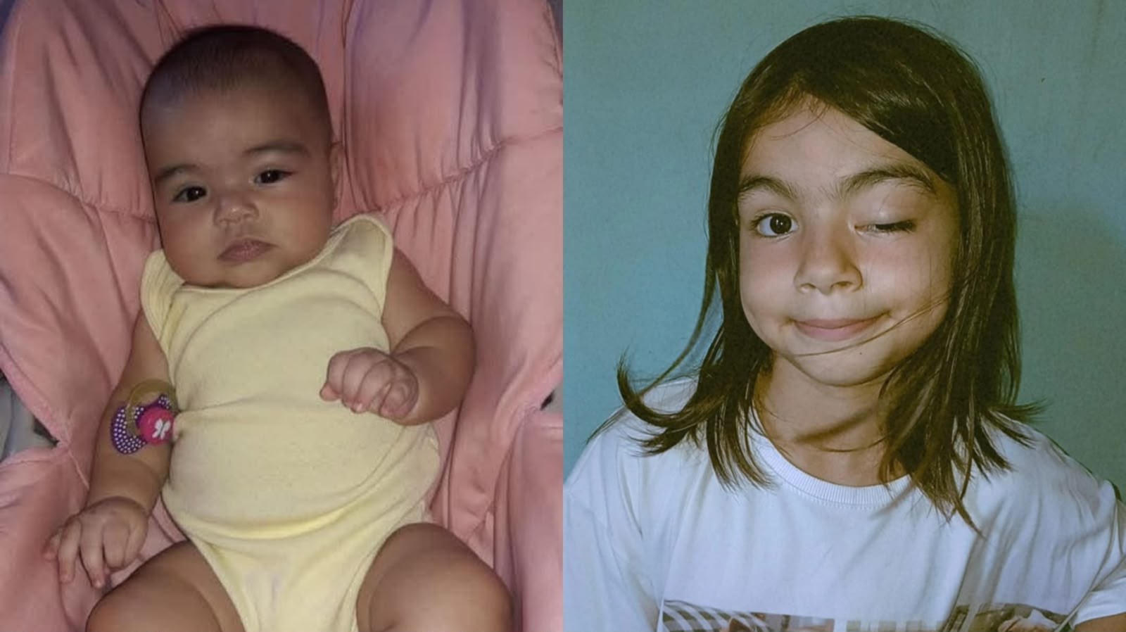Mãe em Cuiabá busca ajuda para tratamento de filha com lesões no cérebro