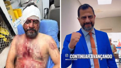 Vereador retoma mandato em Rondonópolis após violento assalto em MT